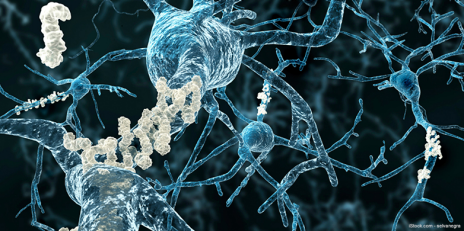 At the axons of neurons, plaques of strucutrally modified proteins (grey) accumulate and are the root cause of neurodegenerative diseases such as Parkinson's or Alzheimer's disease. (Graphics: selvanegra/istockphoto.com)