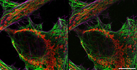 Comparison between confocal and Airyscan image. HeLa cells, red: mitochondria membrane, green: microtubuli, magenta: actin fibres; acquired with LSM 800. Scale bar 5 µm. Sample courtesy of A. Seitz, EPFL, Lausanne, Switzerland. 