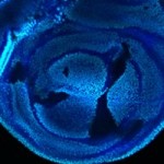 Drosophila wing imaginal disc: Non-stained cells, areas in black, can not modify their histone H3 at the lysin. But the cells can divide and read genes. Dark blue represents non-mutant cells, cyan represents the modification at the lysin. (picture: UZH)