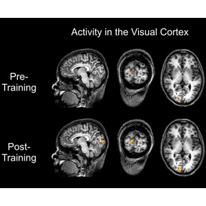 Brain scan showing activity pre- and post-training