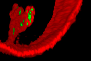 Pseudomonas aeruginosa (green) invades a synthetic vesicle (red) using the lipid zipper. (Source: Thorsten Eierhoff)