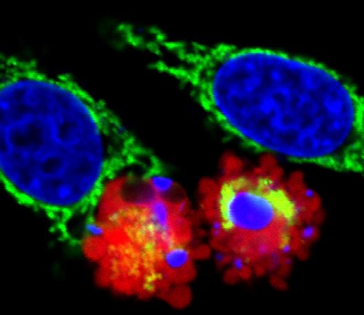 Parkin-expressing cells (red) undergoing programmed cell death.