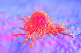 The University of Aberdeen secures £1.5million grant from Cancer Research UK to study how tumours develop 