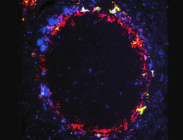 The targeted antigen (yellow) is selectively taken up by macrophages (blue, red).