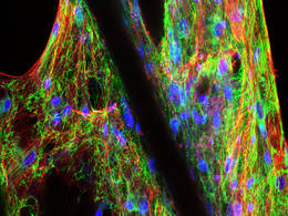 Confocal laser microscopy of a scaffold populated with human mesenchymal precursor cells. Image: D. Hutmacher / QUT