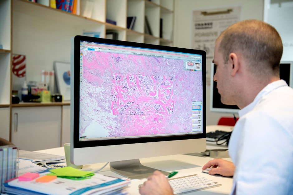 Pathologist examines tumor tissue