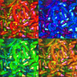 ‘Fluorescence in situ Hybridization (FISH)’-detection of intestinal bacteria. Picture: Stecher, LMU
