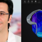 Dr. Georgios Kollias, M.D. comments on the enrollment of the first patient in the Clinical Study for Cardiac Resynchronization Therapy Using XSpline Cloud's Non-Invasive Technology