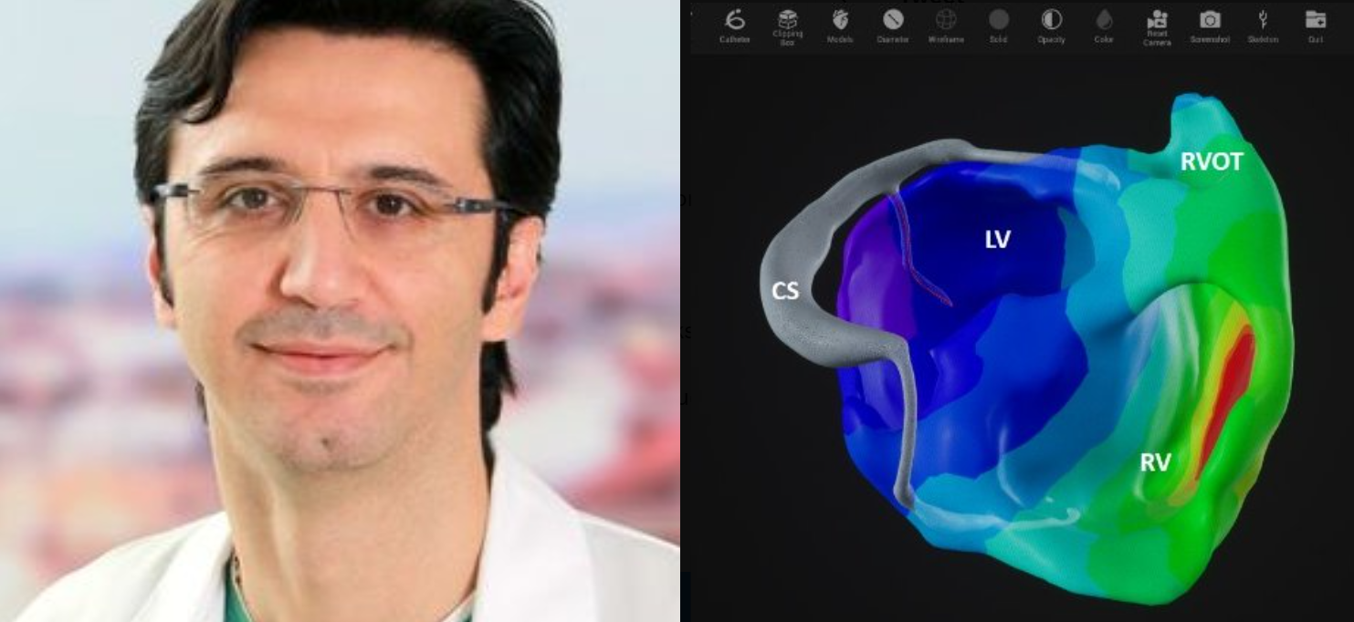 Dr. Georgios Kollias, M.D., comments on the enrollment of the first patient in the Clinical Study for Cardiac Resynchronization Therapy Using XSpline Cloud's Non-Invasive Technology